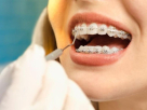 Signature By Dr. Naeem Orthodontic And Dentofacial Aesthetic