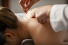 Beijing Wellbeing Acupuncture Therapy Center