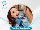 Al Dehyafa Specialized Orthodontic & Dental Clinic