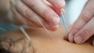 Ying Ji Health Acupuncture Center