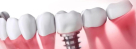 Shine & Smile Dental Clinic