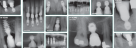 Integrated Bicon Dental Equipment Trading