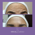 Derma Line Skin & Laser Clinic