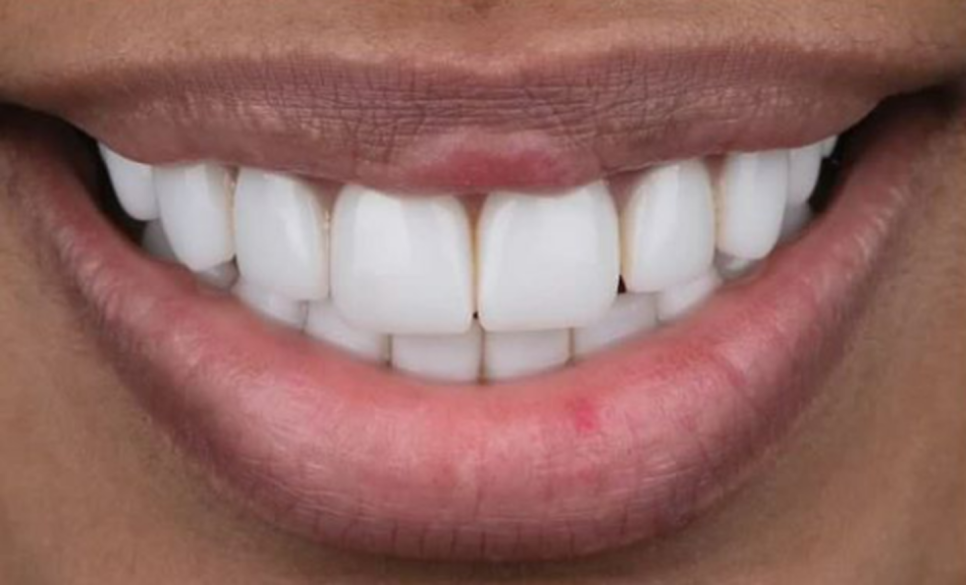 Glory Dental Lab