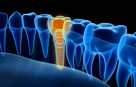 Revive Dental Clinic