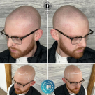 Creative Scalps