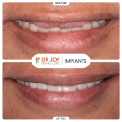 Dr. Joy Dental Clinic