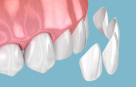 Manhattan Tooth Design