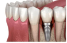 Dento Art Dental Lab