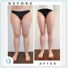Dr. Heck Lipo Clinic