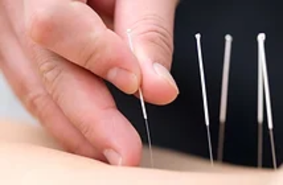 Natural Healing Acupuncture & Hijama Medical Center