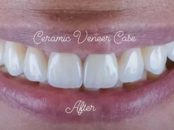 Marble Dental Clinic