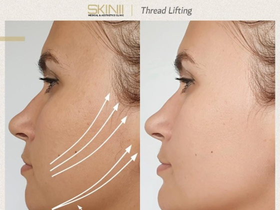 SKIN 111 Medical & Aesthetics Clinic