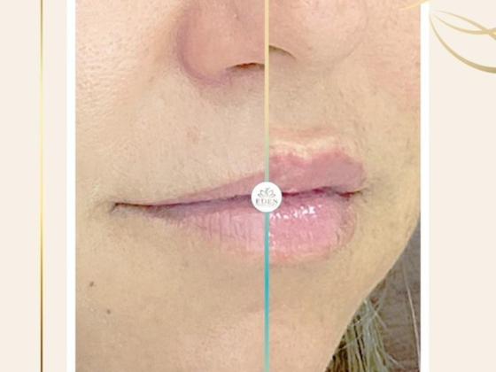 Eden Derma Clinic