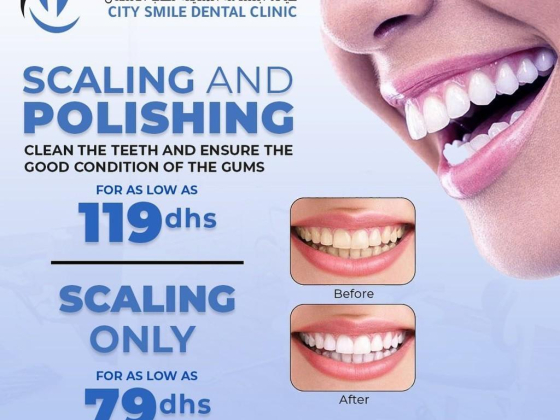 City Smile Dental Clinic