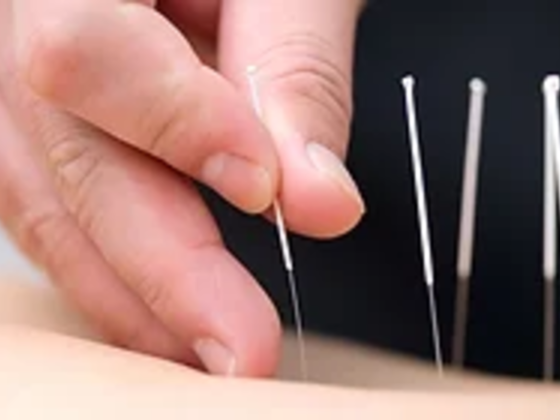 Natural Healing Acupuncture & Hijama Medical Center