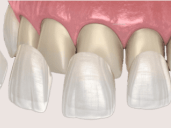 Ceramica Dental Lab