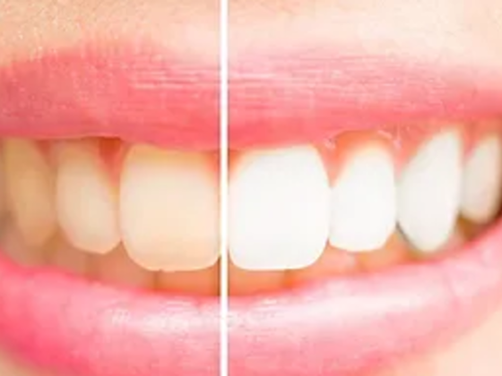 Hey Dental Clinic