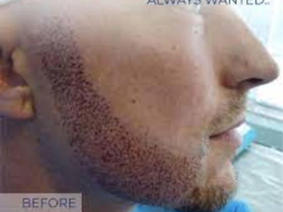 Alborj Hair Clinic - Hair Transplant Clinic