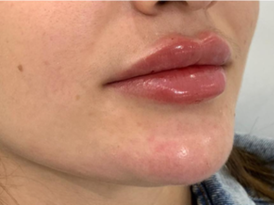 Royal Model