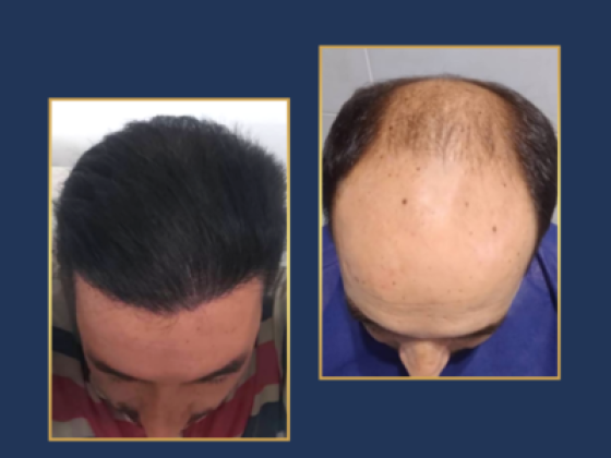 Global Hair Centre