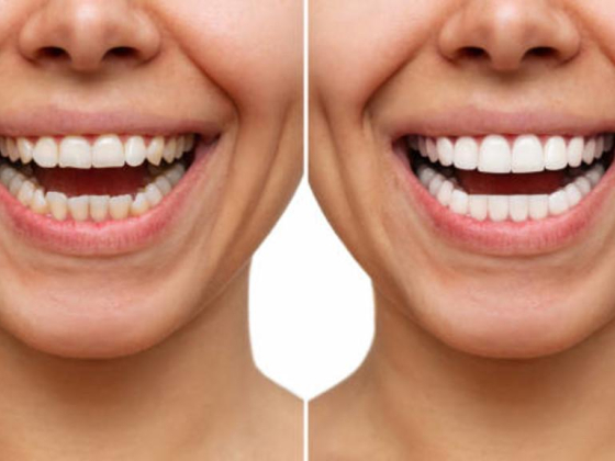 Manhattan Tooth Design
