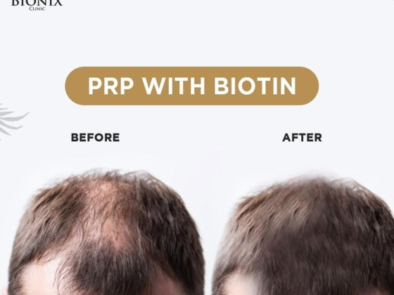 Bionix Clinic
