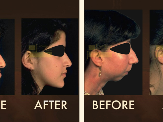 Orthognathic Surgery Centre