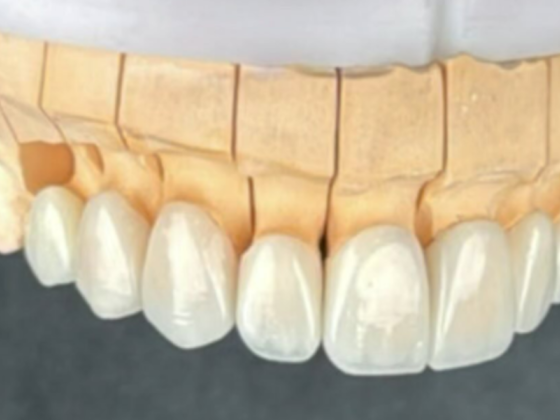 Glory Dental Lab