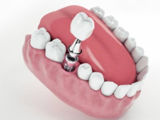 Saphiredent Dental Clinic