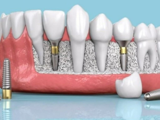 Sejovi Dental & Implant Center