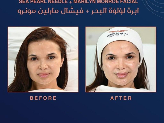 Hoor Al Aliaa Polyclinic