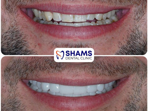 Shams Dental Clinic