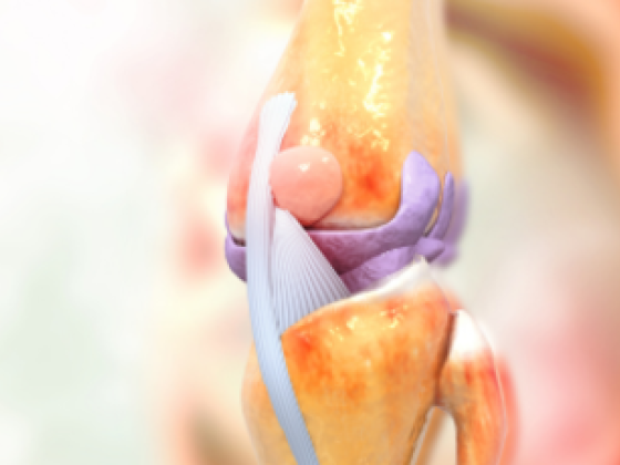 Pure Spine & Joint Specialists