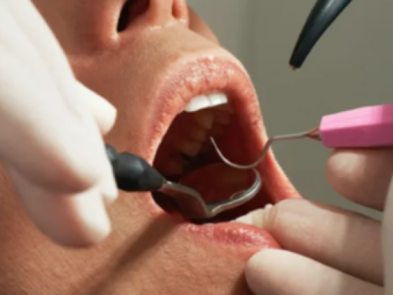Top Smile Dental Clinic
