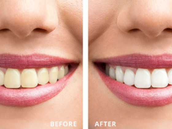 Art Of Aesthetic Poly Clinic