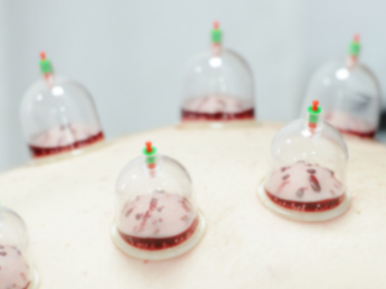 Natural Healing Acupuncture Center
