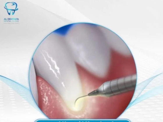 Al Dehyafa Specialized Orthodontic & Dental Clinic