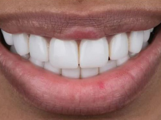 Glory Dental Lab