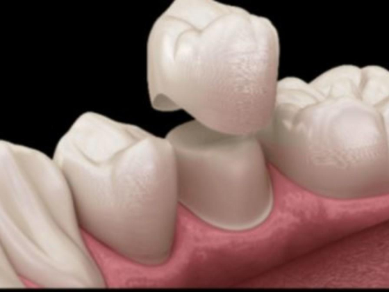 Dento Art Dental Lab